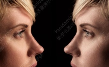 加拿大电影《光影之书》[2013][高清中字/2.63G][百度网盘]